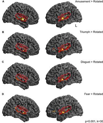 Investigating the Neural Basis of Theta Burst Stimulation to Premotor Cortex on Emotional Vocalization Perception: A Combined TMS-fMRI Study